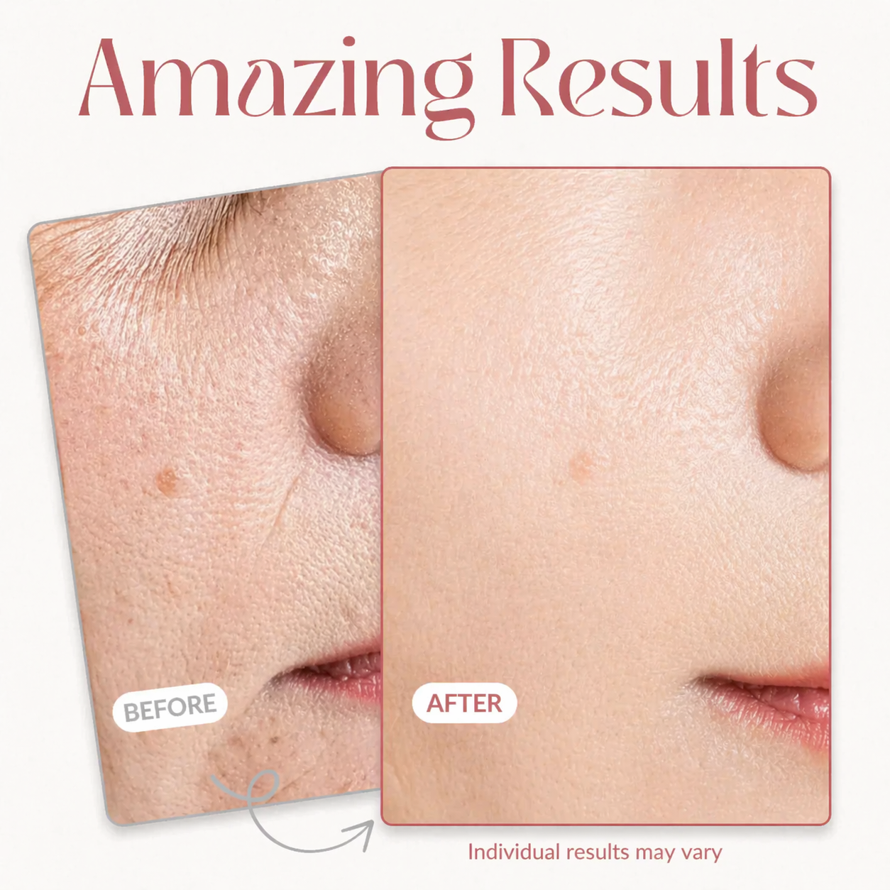 Targeted Fine Line Filler